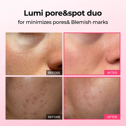 Lumi firm & lift Duo